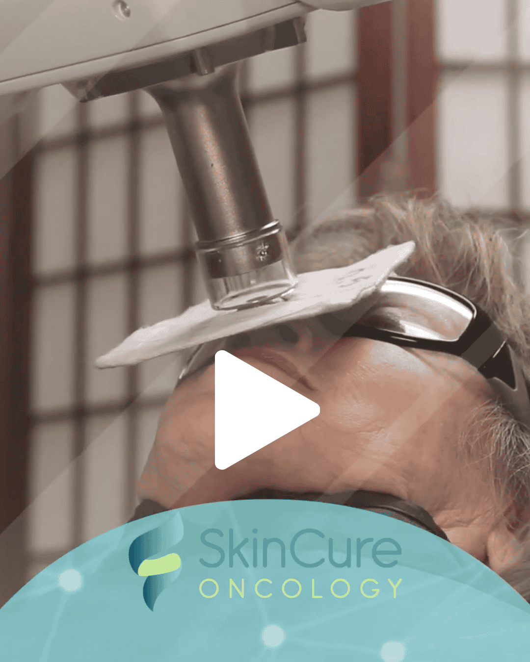 Skincure Oncology video example with white play button